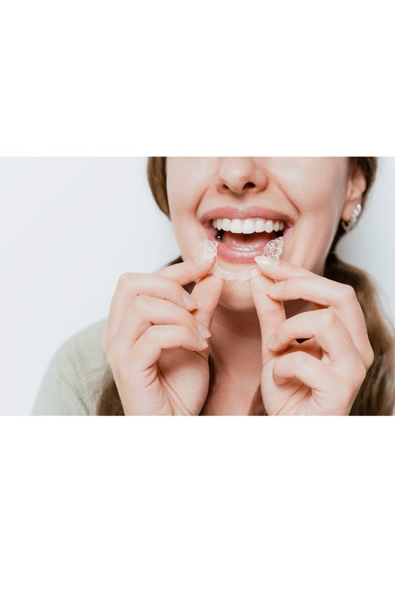 A smiling woman placing a clear aligner tray