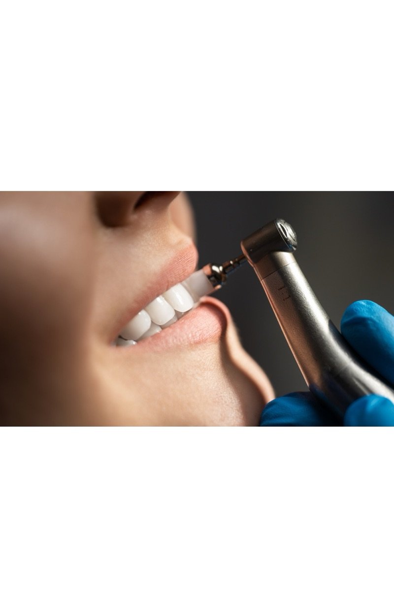A patient's bright smile during a professional dental polishing appointment